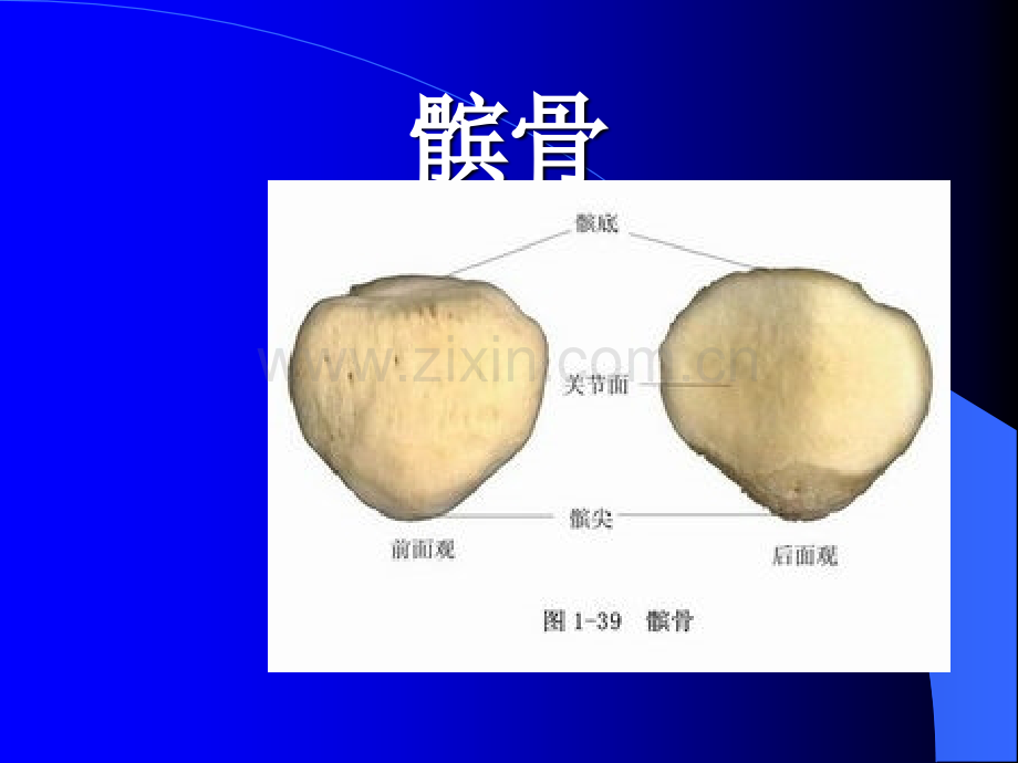 髌骨骨折的护理查房.ppt_第3页