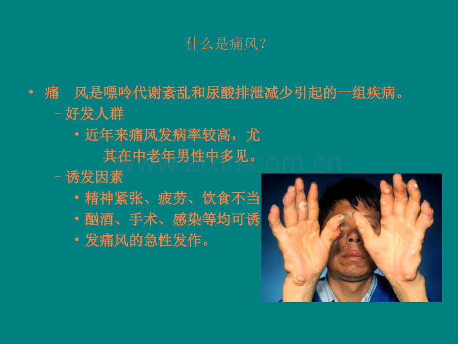 痛风病人的饮食指导ppt.ppt_第3页