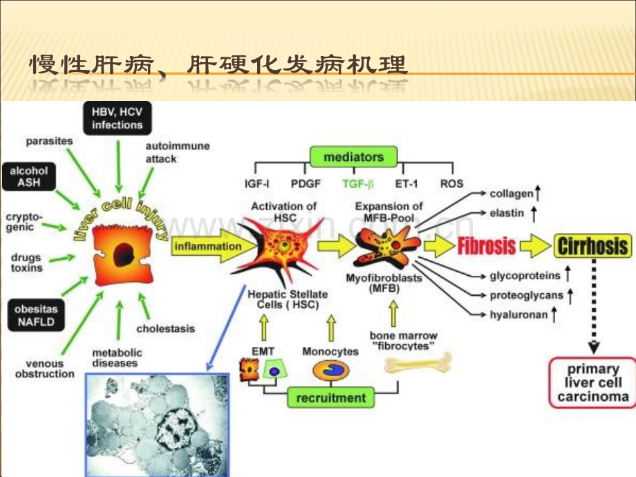 肝癌影像诊断.ppt_第3页