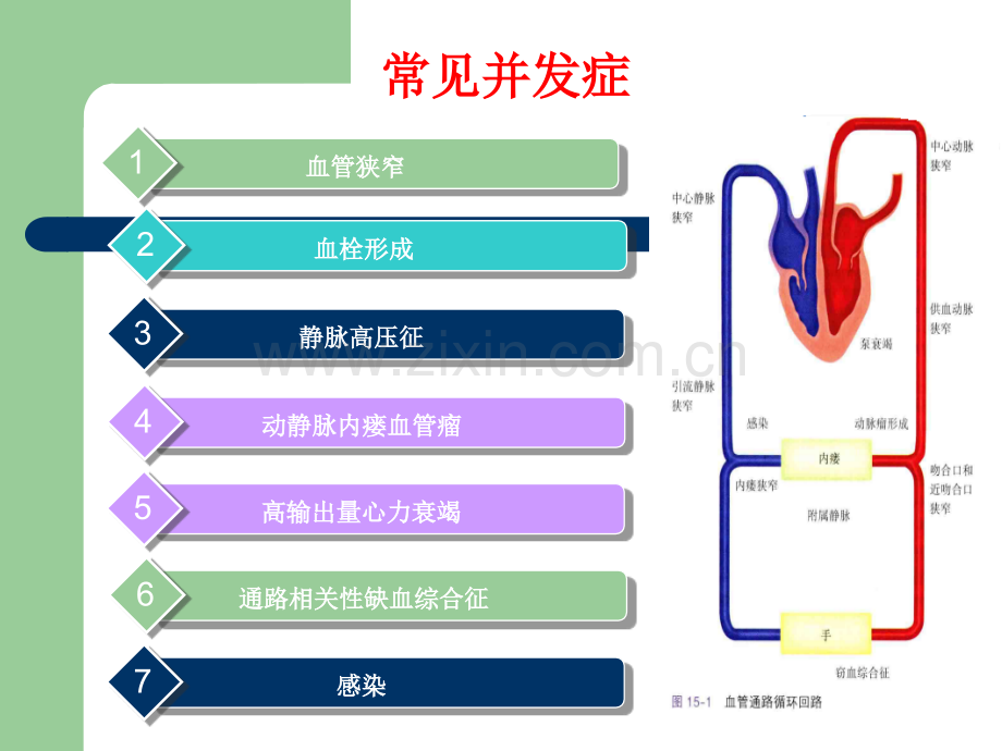 自体动静脉内瘘并发症处理ppt课件.pptx_第3页