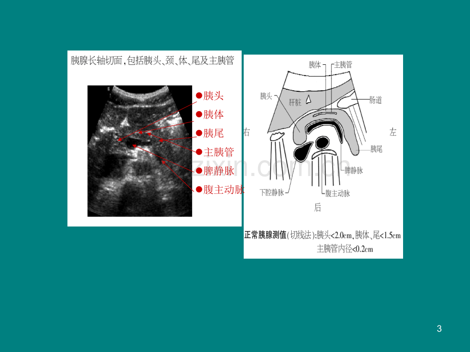 胰腺B超解剖PPT课件.ppt_第3页