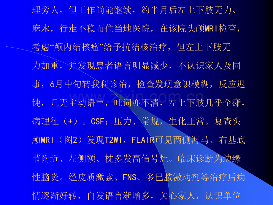 边缘性脑炎诊断与治疗ppt课件.ppt_第2页