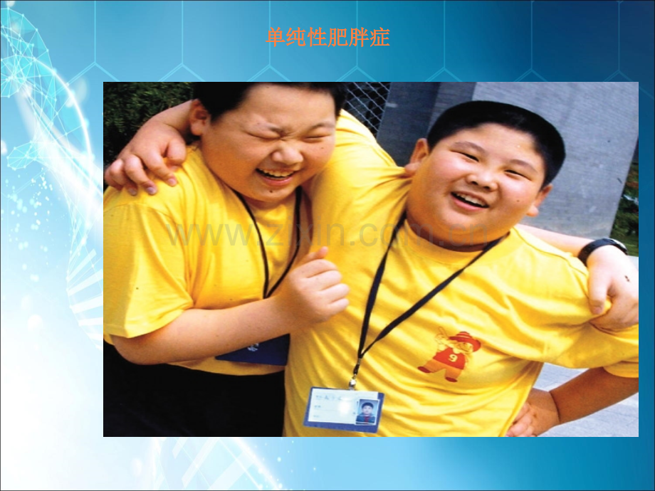 肥胖防治ppt课件.ppt_第1页