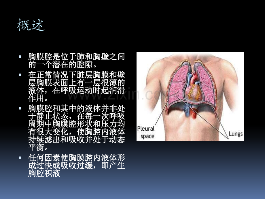 胸腔积液(优质课件).pptx_第2页