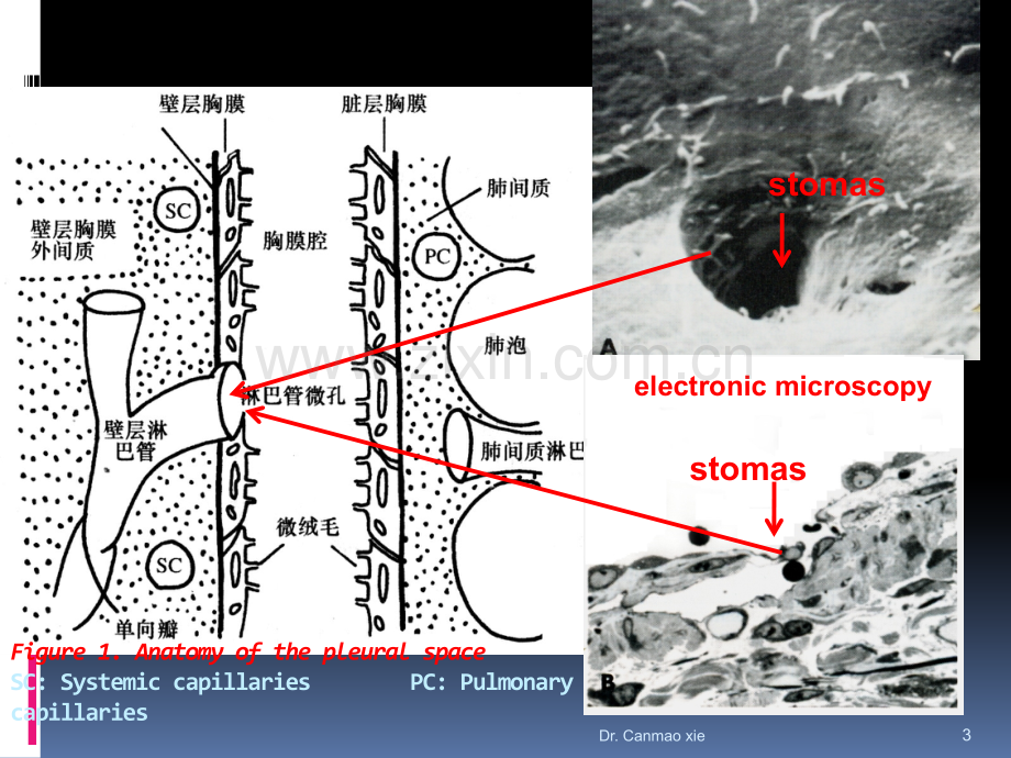 胸腔积液(优质课件).pptx_第3页