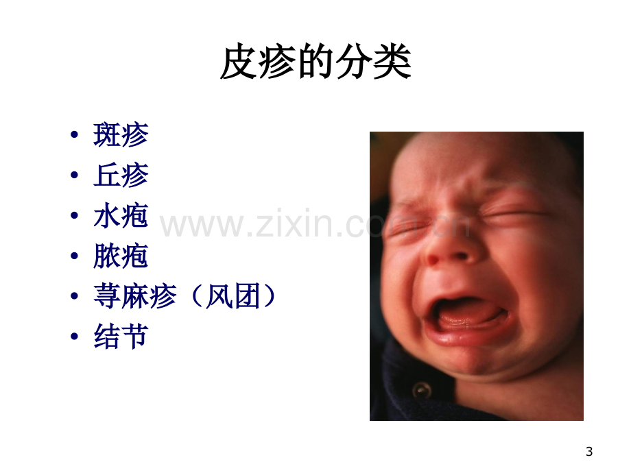 小儿皮疹鉴别与诊断PPT课件.ppt_第3页