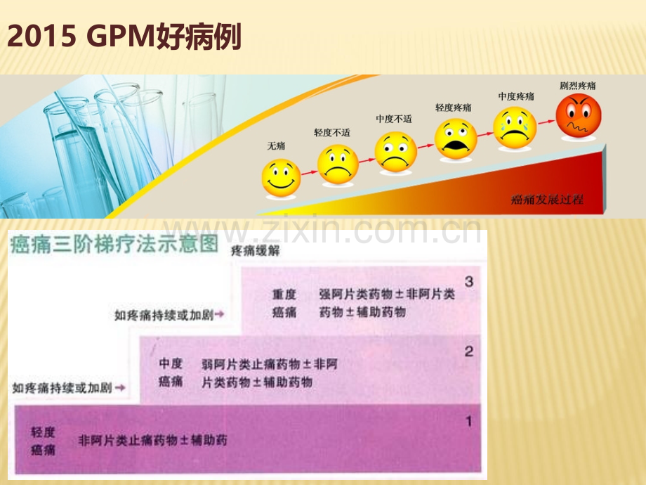 癌痛规范化治疗PPT.ppt_第3页