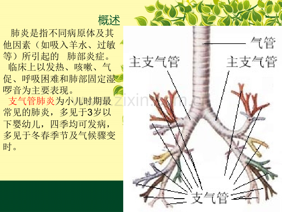 支气管肺炎护理查.pptx_第3页