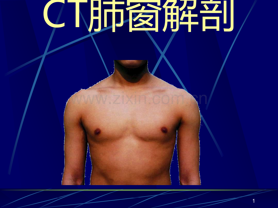 CT肺窗解剖PPT课件.ppt_第1页