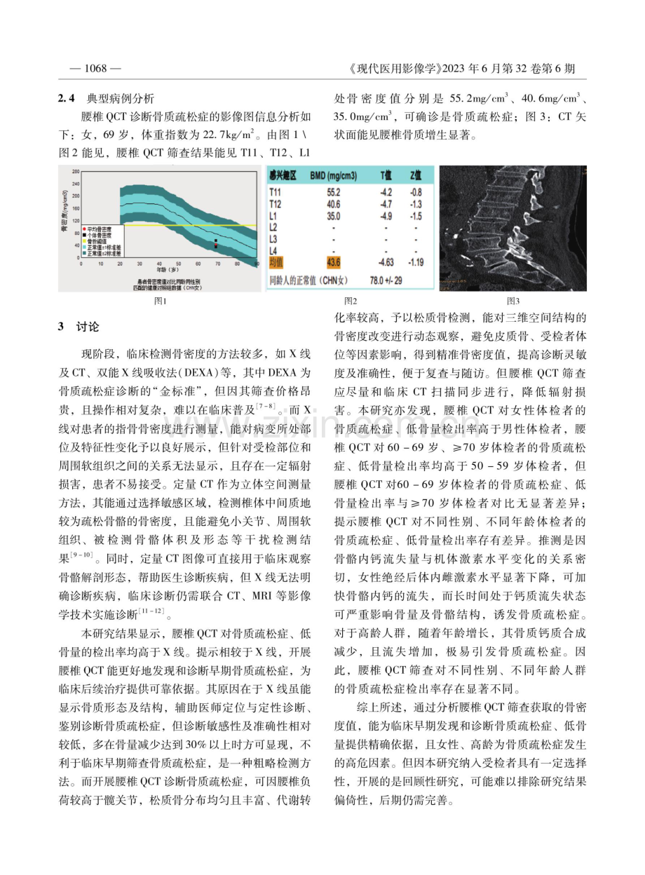 腰椎定量CT在骨质疏松症患者诊断中应用价值研究.pdf_第3页