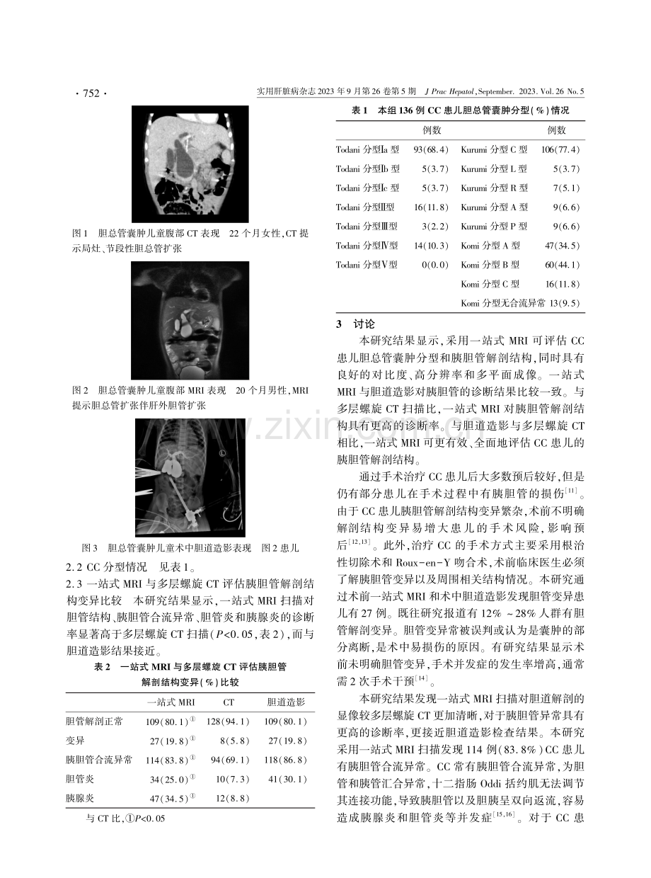 一站式磁共振成像评估儿童胆总管囊肿和胰胆管解剖结构价值分析.pdf_第3页