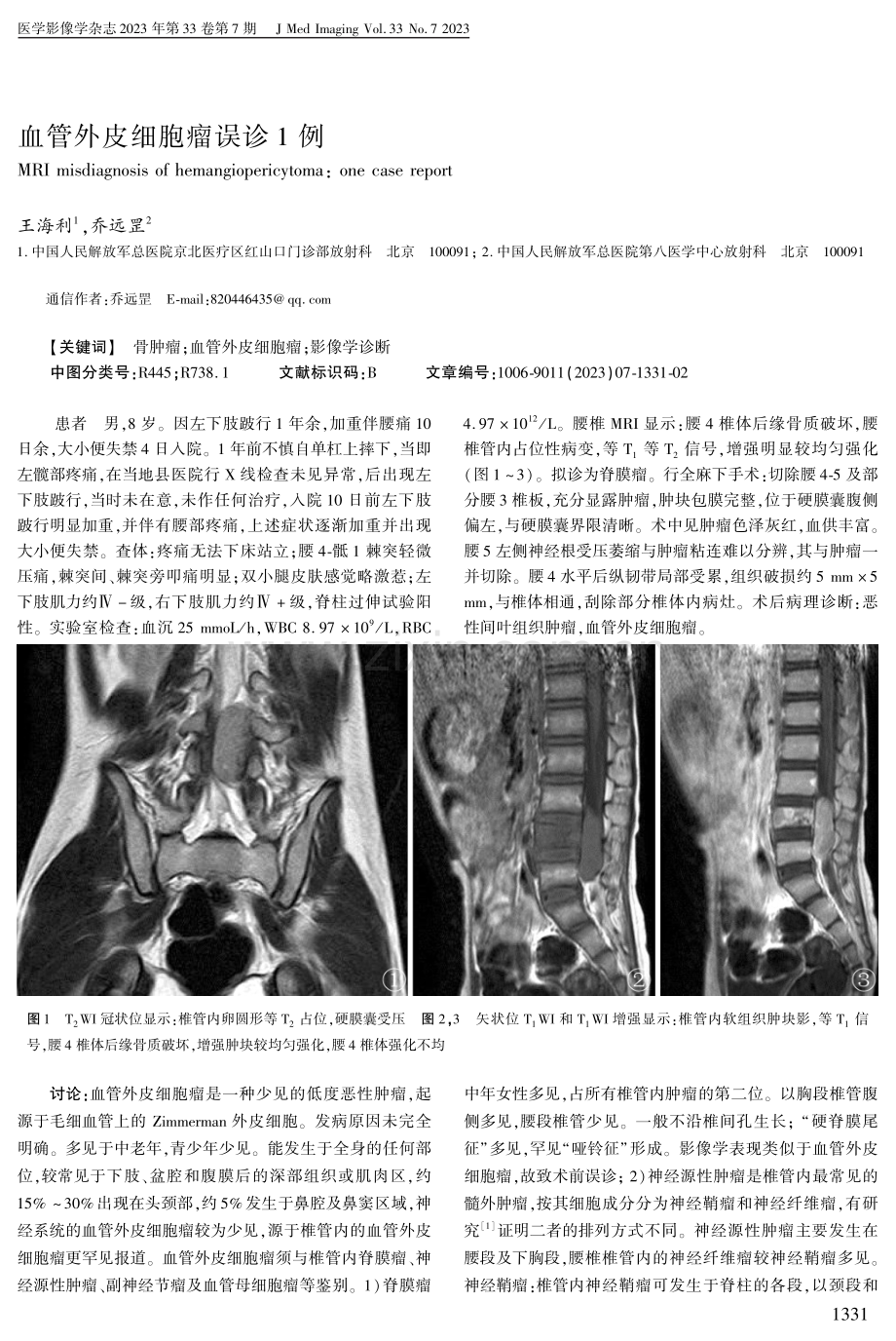 血管外皮细胞瘤误诊1例.pdf_第1页