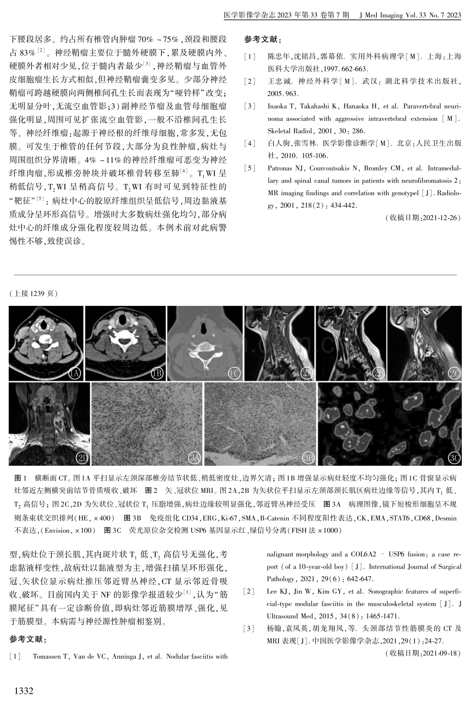 血管外皮细胞瘤误诊1例.pdf_第2页