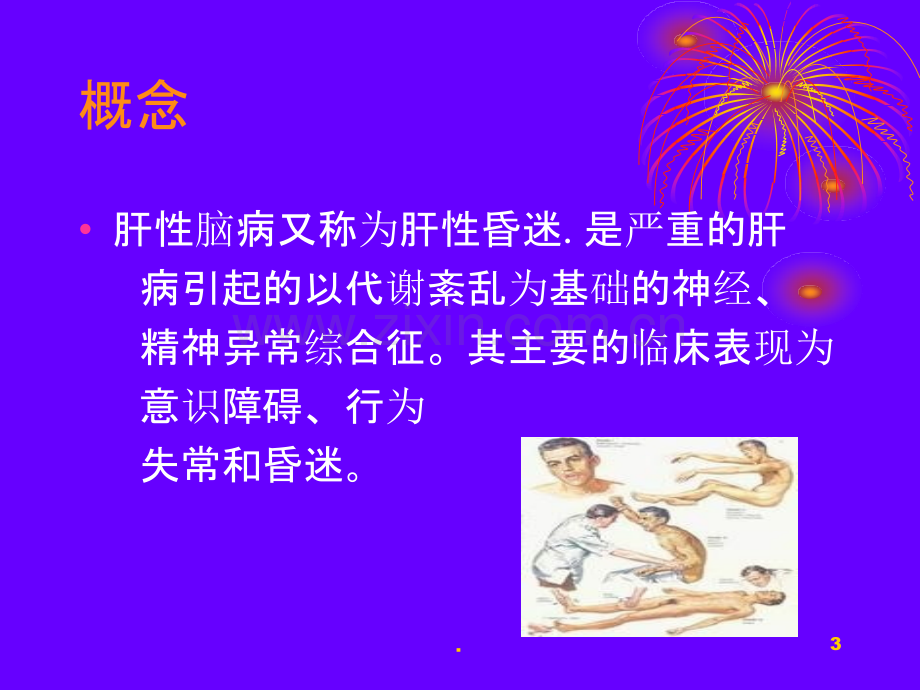 肝性脑病PPT课件.ppt_第3页