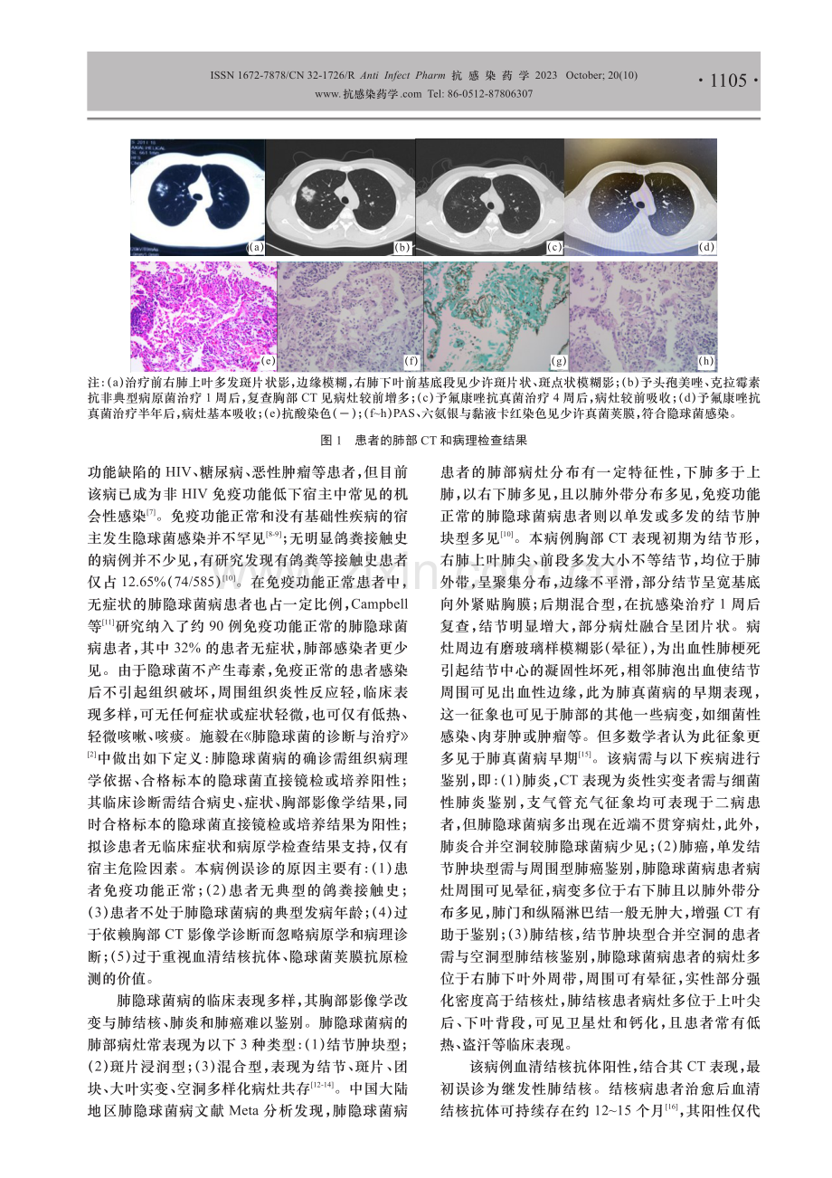 1例肺隐球菌病误诊为肺结核病例的临床诊疗分析.pdf_第3页