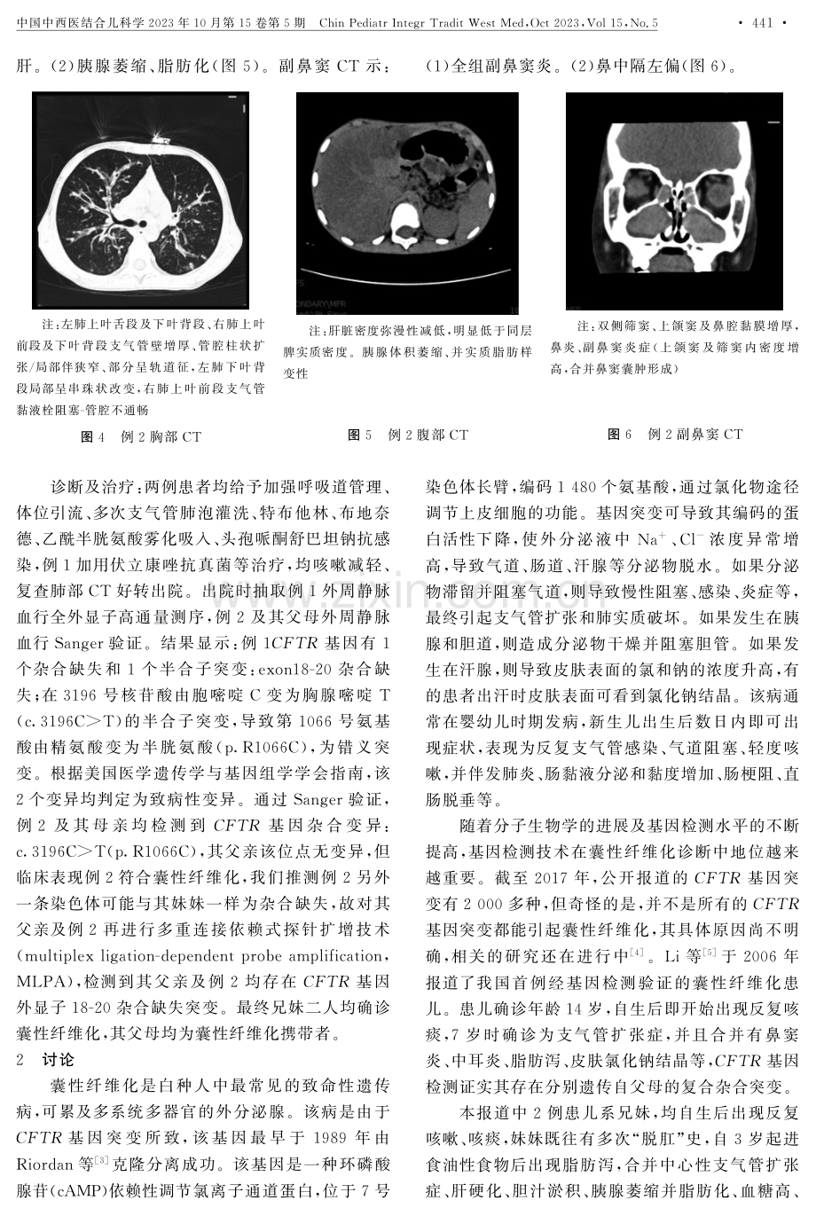 CFTR基因突变致囊性纤维化家系报道及文献复习.pdf_第3页