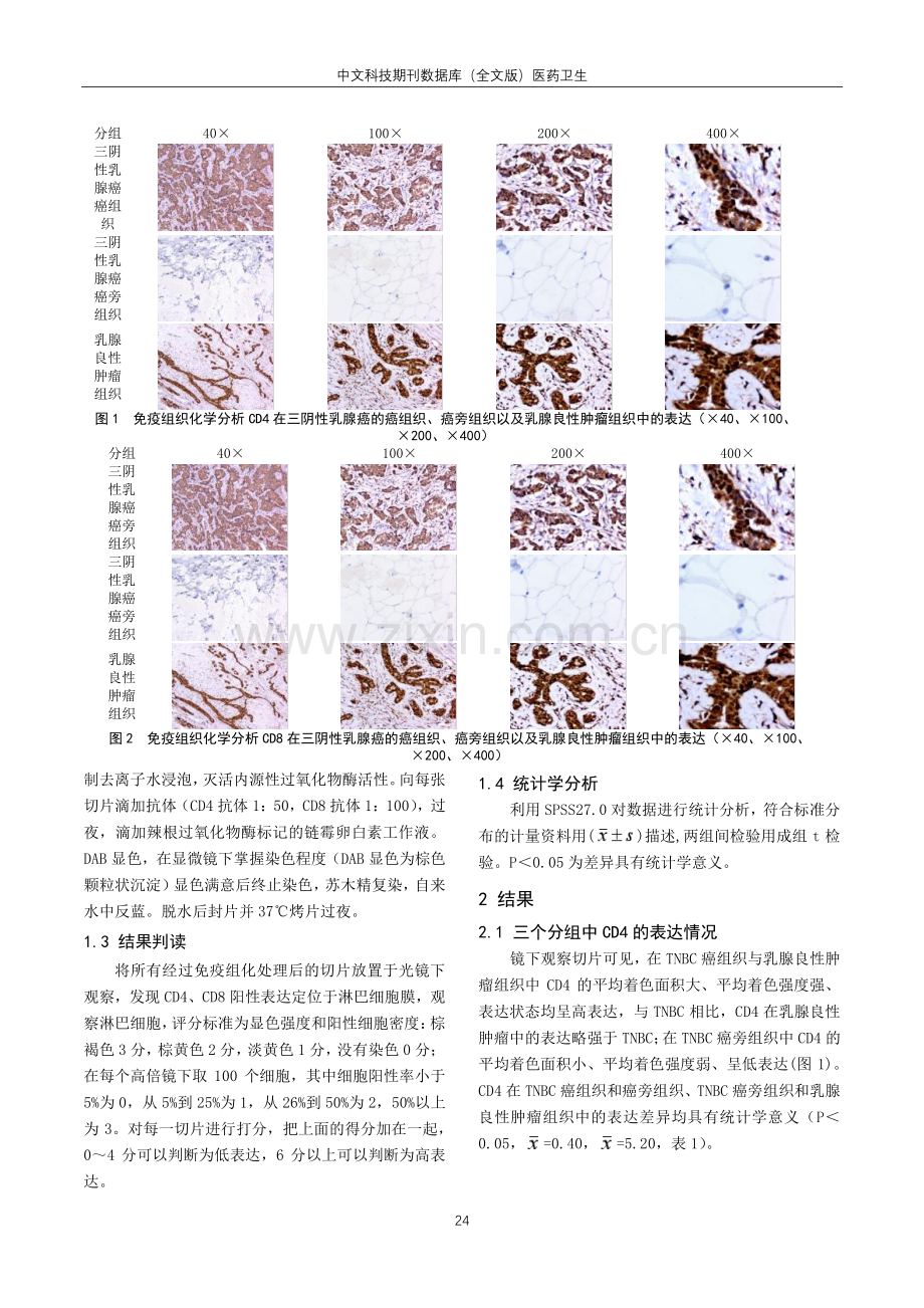 CD4、CD8在三阴性乳腺癌中的表达及意义.pdf_第2页