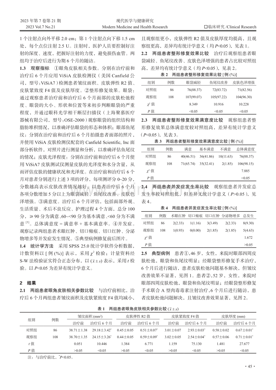 A型肉毒毒素联合眼袋整形术对眼周皮肤松弛的效果分析.pdf_第2页