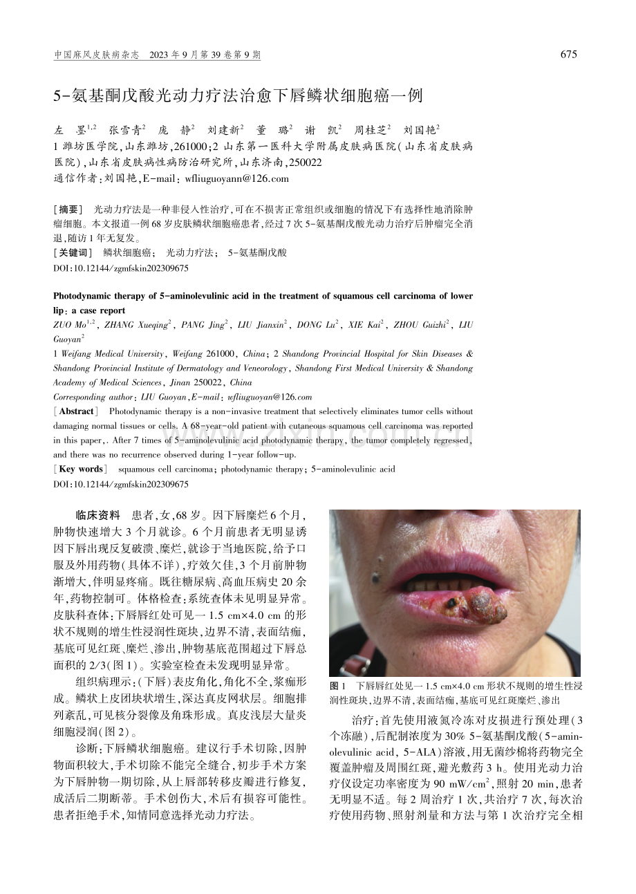 5-氨基酮戊酸光动力疗法治愈下唇鳞状细胞癌一例.pdf_第1页