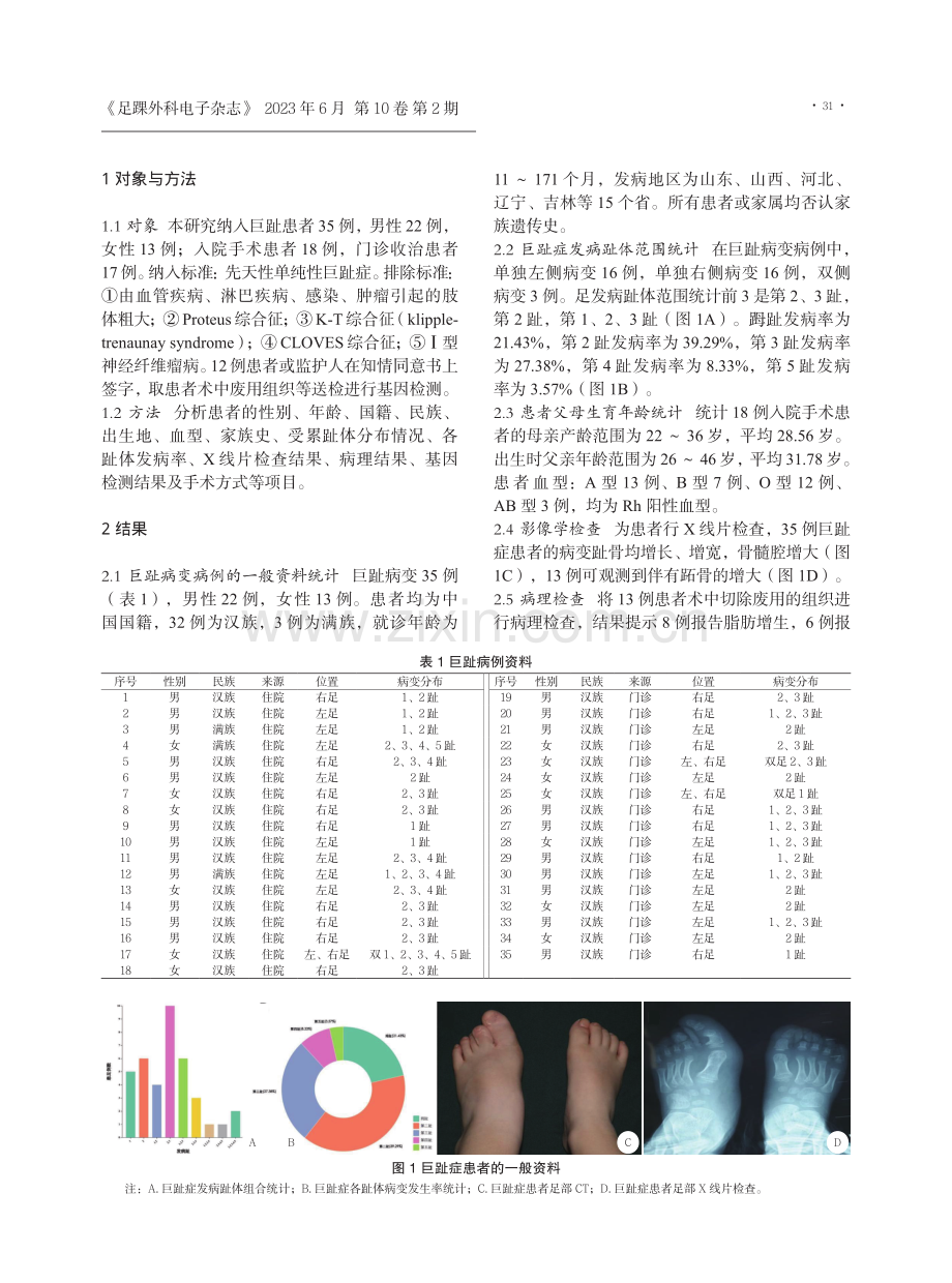 35例巨趾症的临床特点分析.pdf_第2页