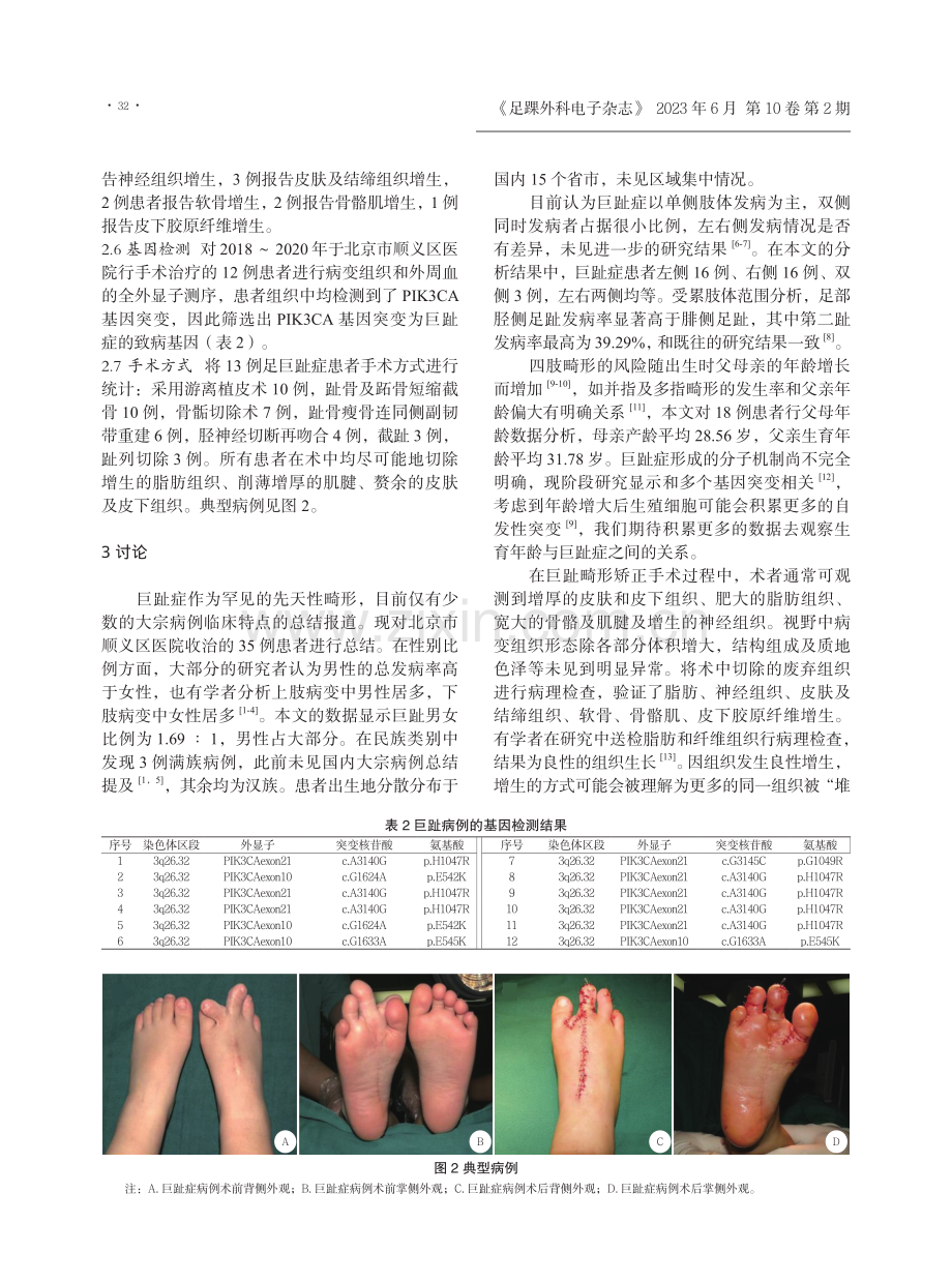 35例巨趾症的临床特点分析.pdf_第3页