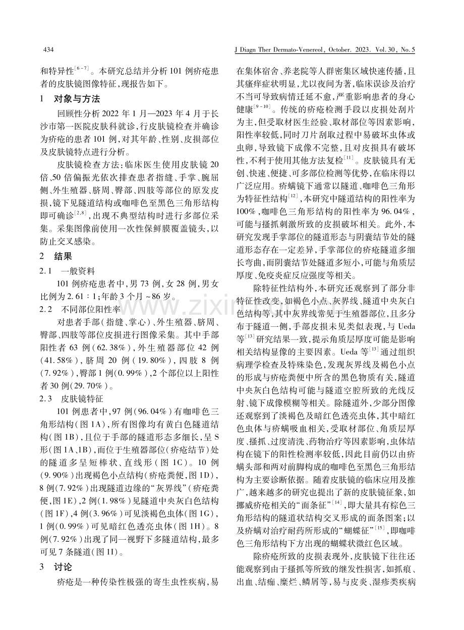 101例疥疮皮肤镜图像分析.pdf_第2页