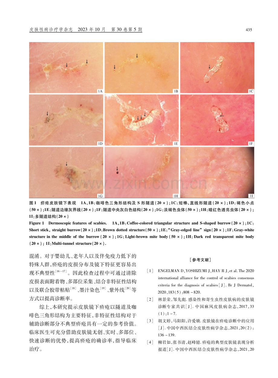 101例疥疮皮肤镜图像分析.pdf_第3页