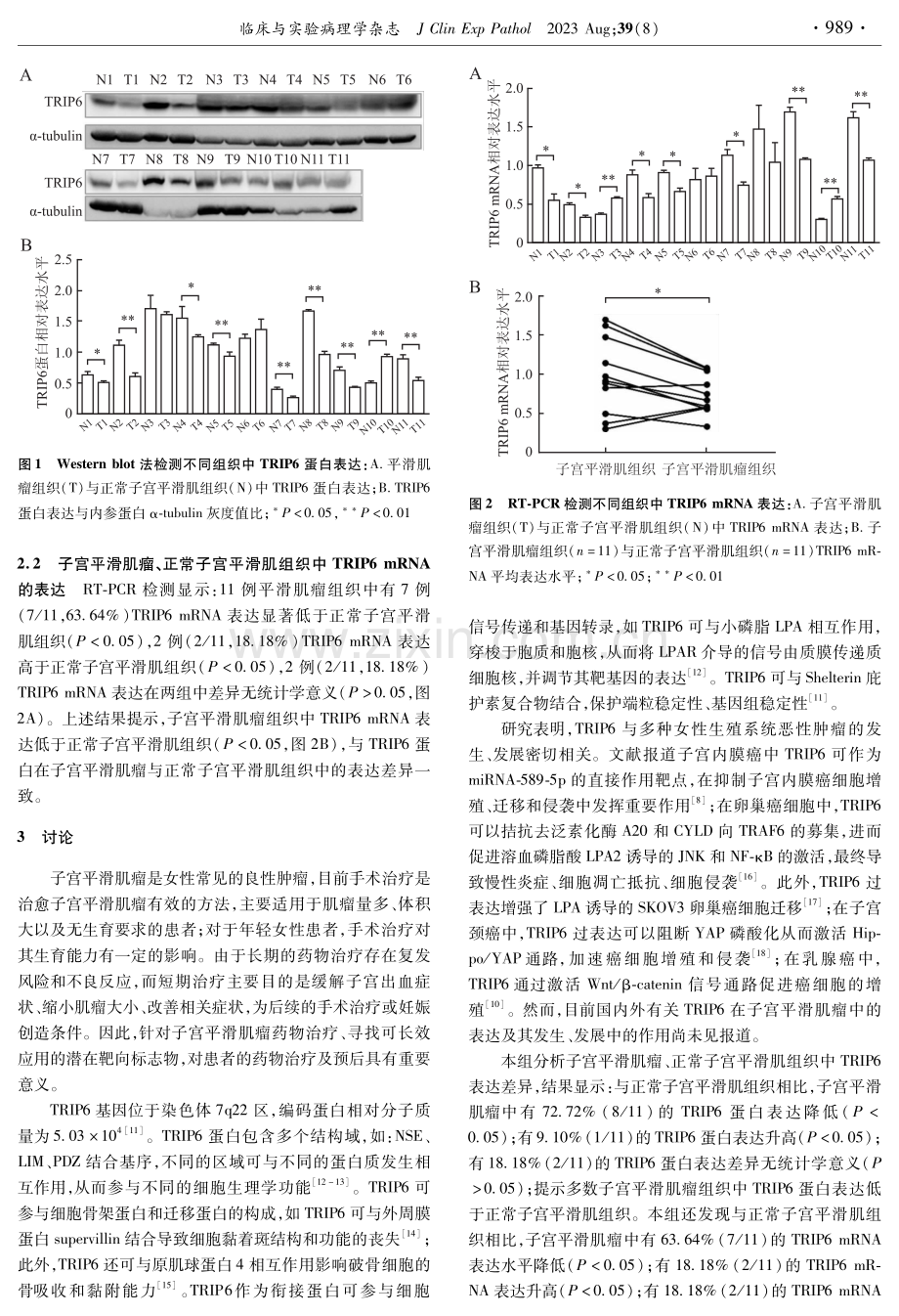 子宫平滑肌瘤中TRIP6蛋白及mRNA的表达.pdf_第2页