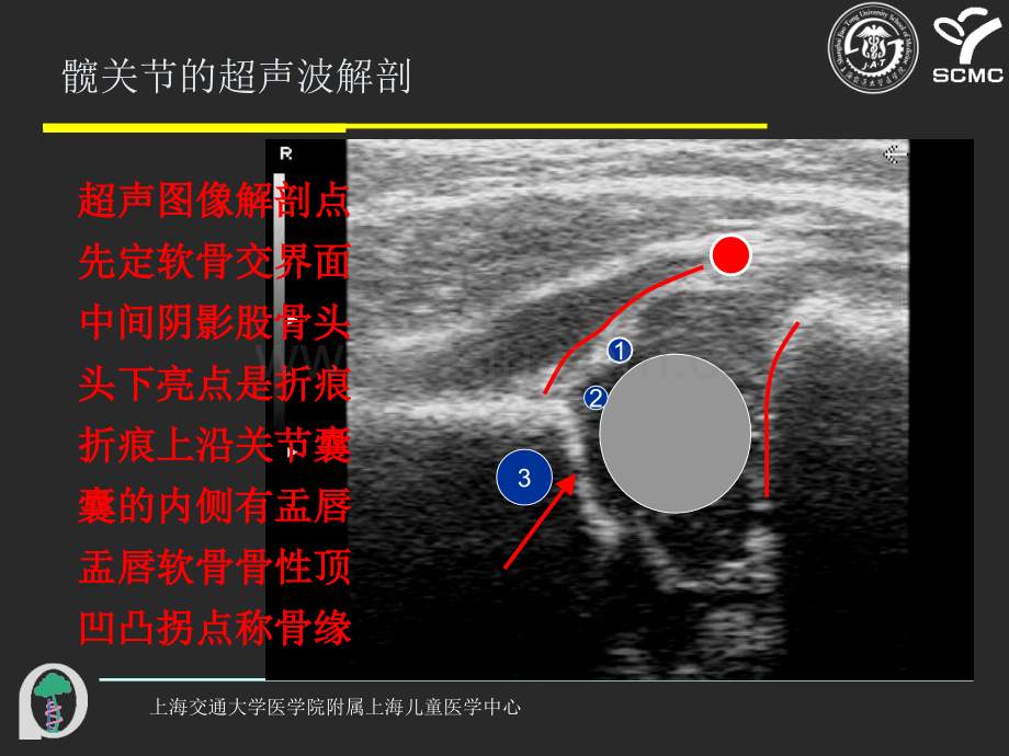 髋关节超声波检查的操作.pptx_第2页