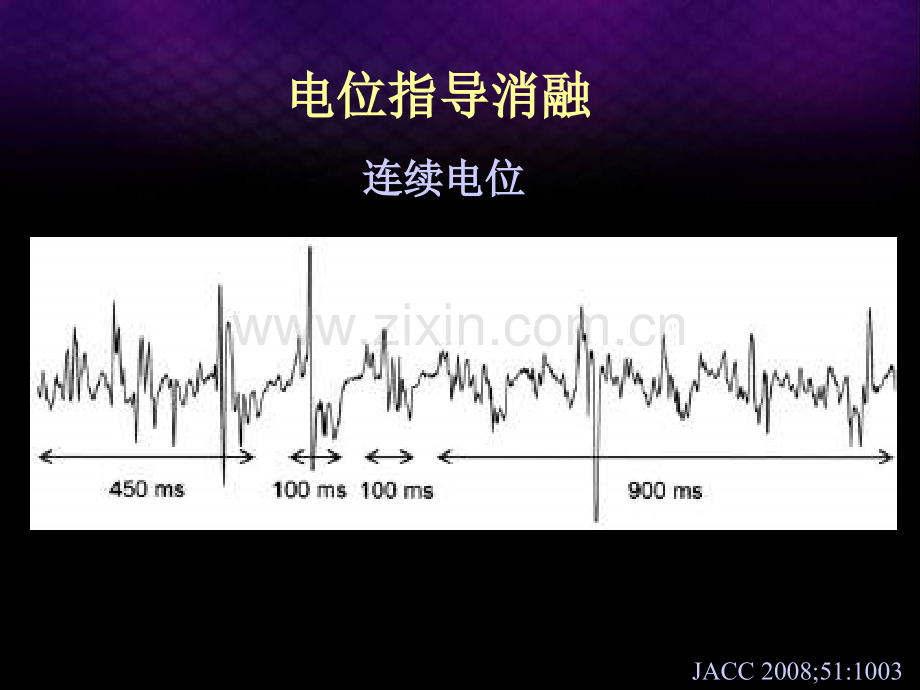 慢性房颤导管消融的技术与评价马长生.pptx_第3页