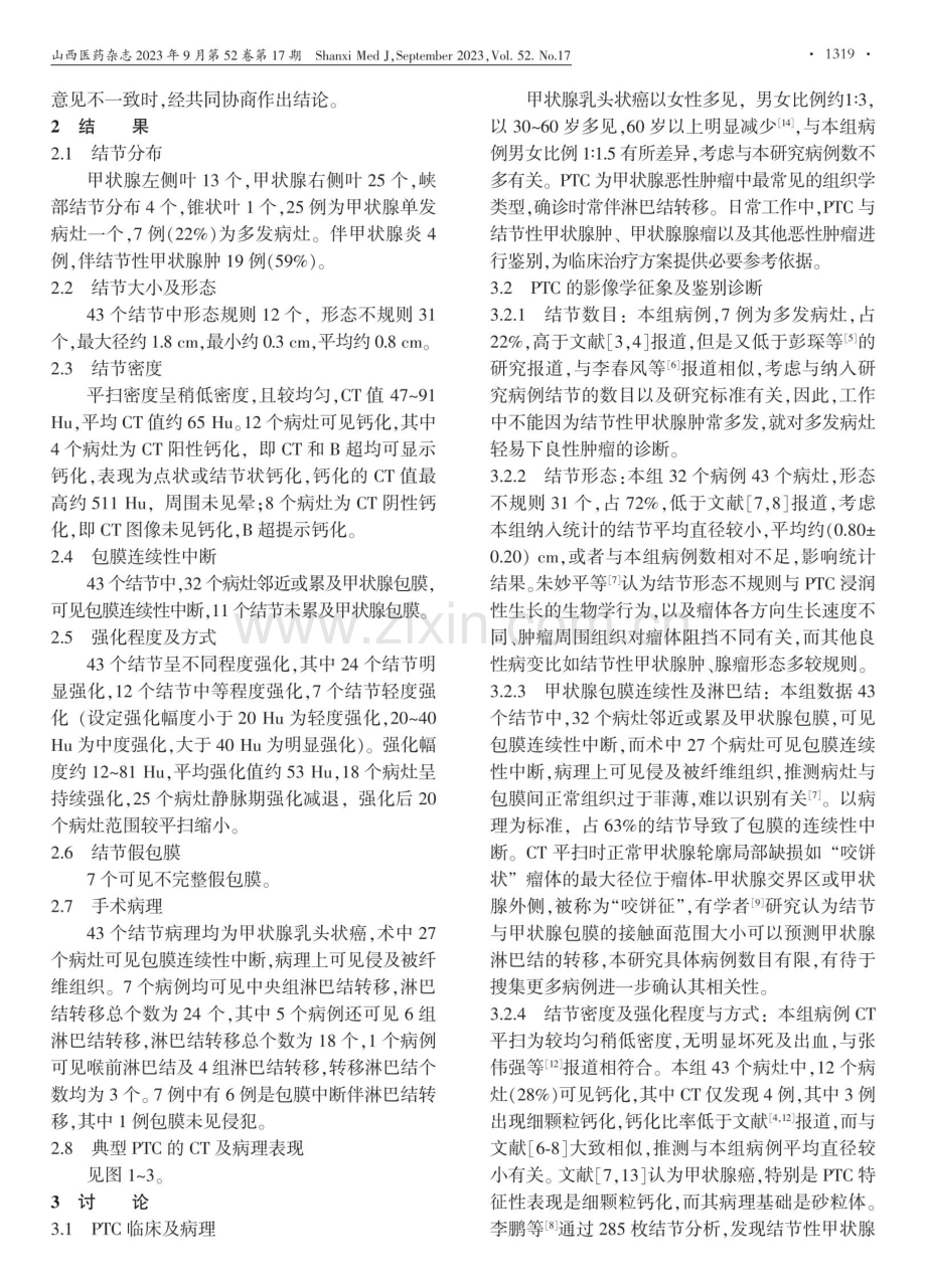 320排CT对甲状腺乳头状癌的临床价值与病理对照分析.pdf_第2页