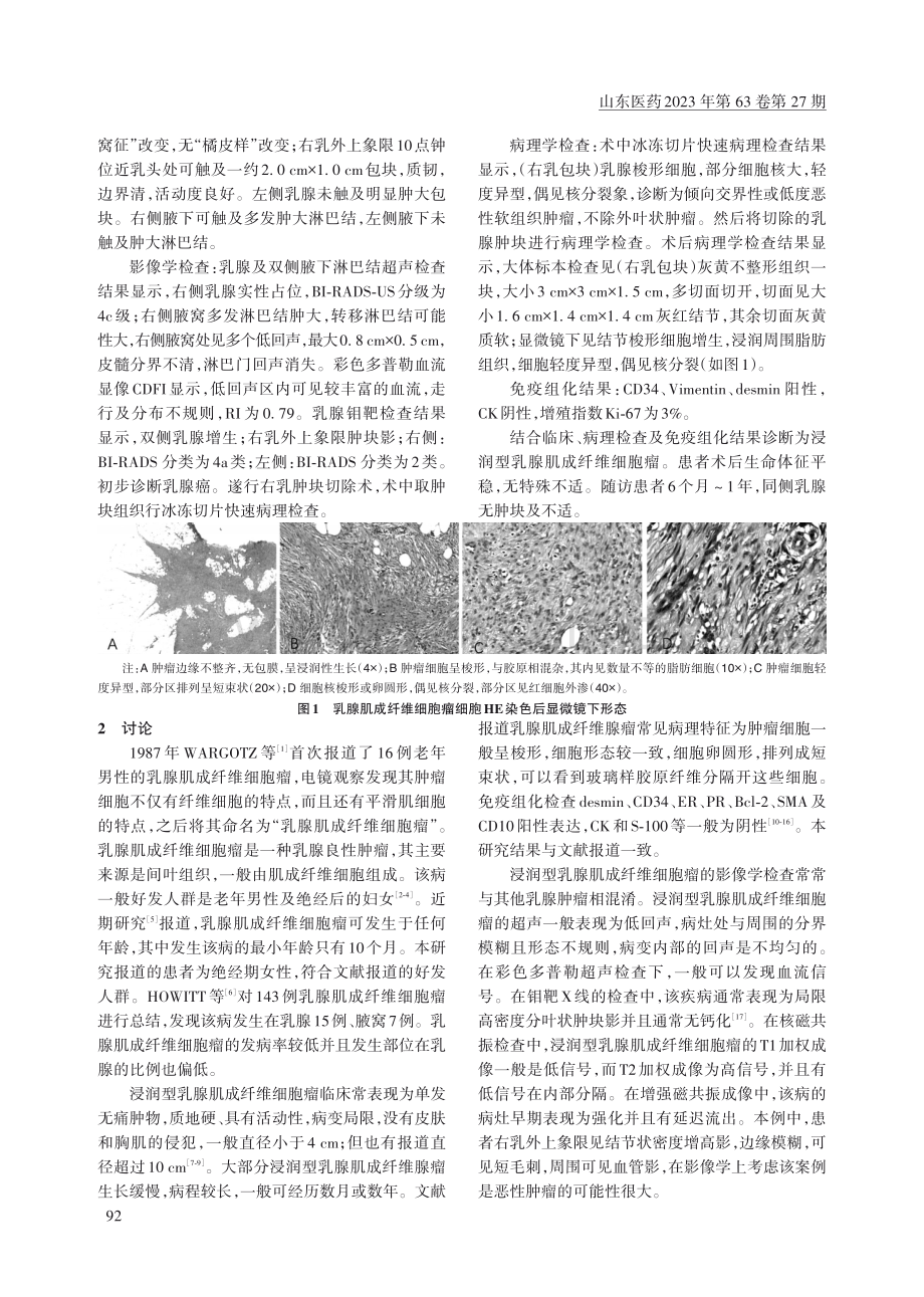 1例浸润型乳腺肌成纤维细胞瘤的诊断.pdf_第2页