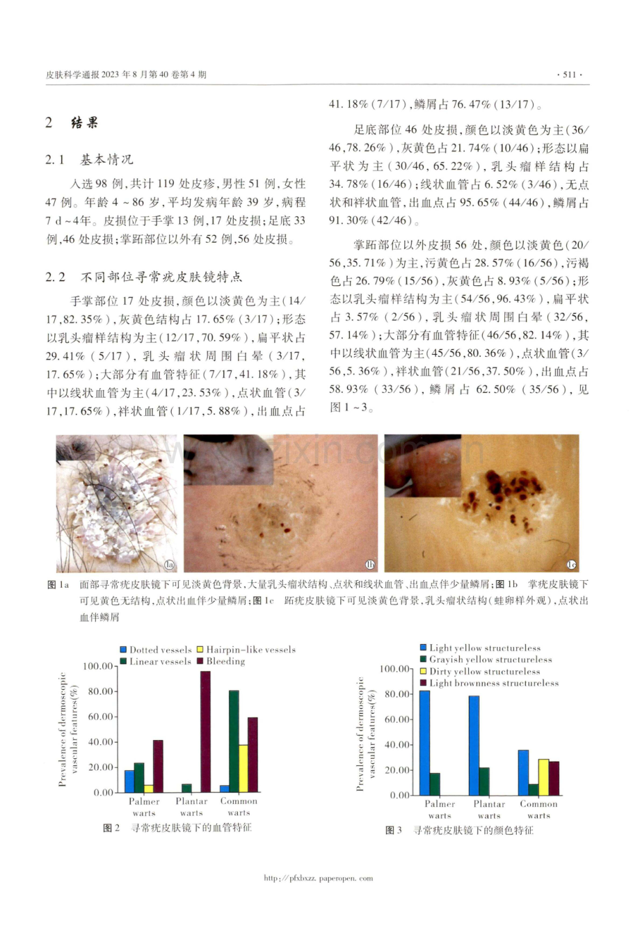 98例寻常疣的皮肤镜特征分析.pdf_第3页