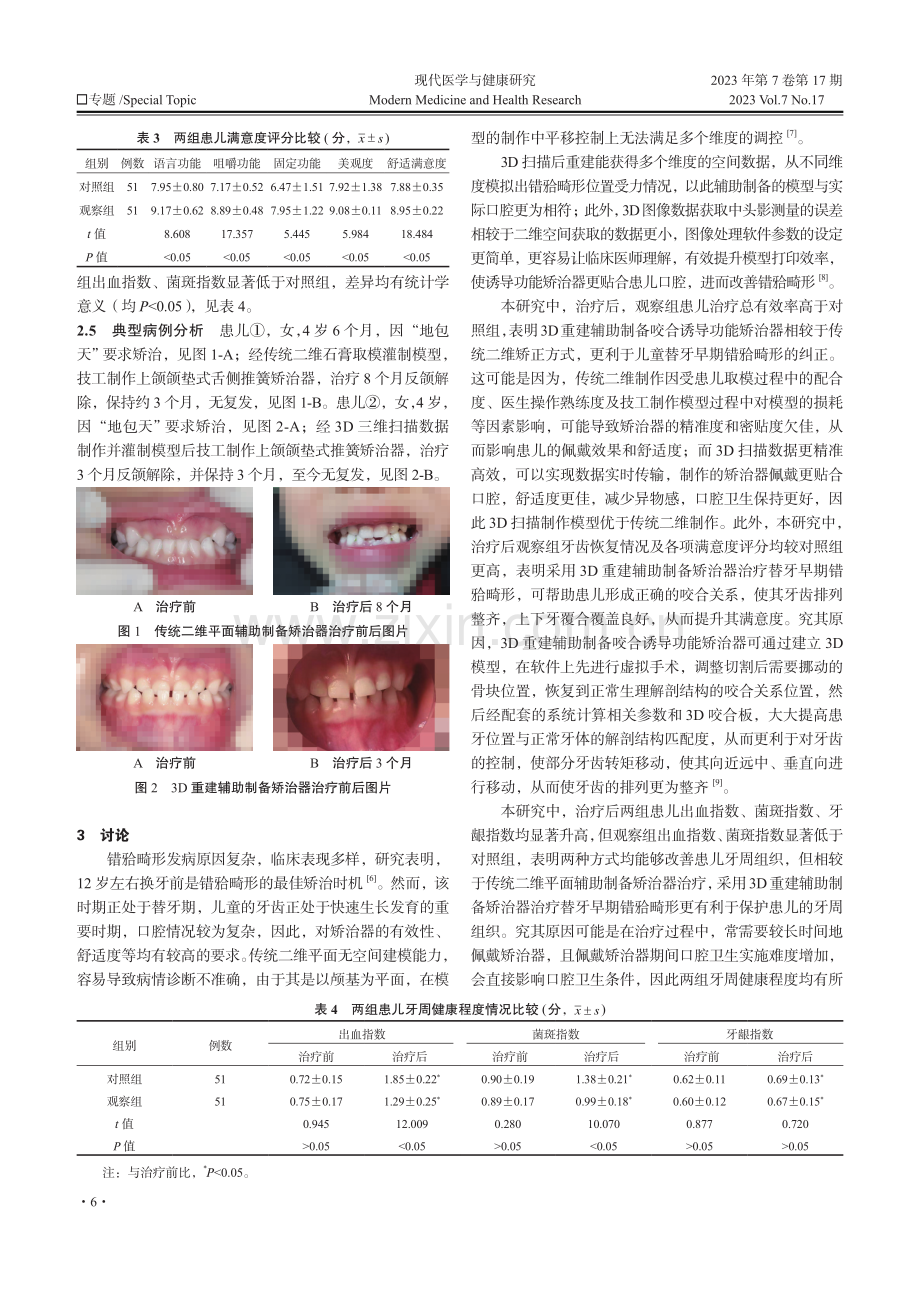 3D重建辅助制备咬合诱导功能矫治器对儿童替牙早期错畸形的治疗效果分析.pdf_第3页