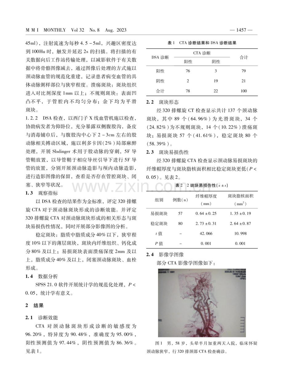 320排螺旋CT血管成像评价颈动脉斑块形成及易损性的临床价值.pdf_第2页