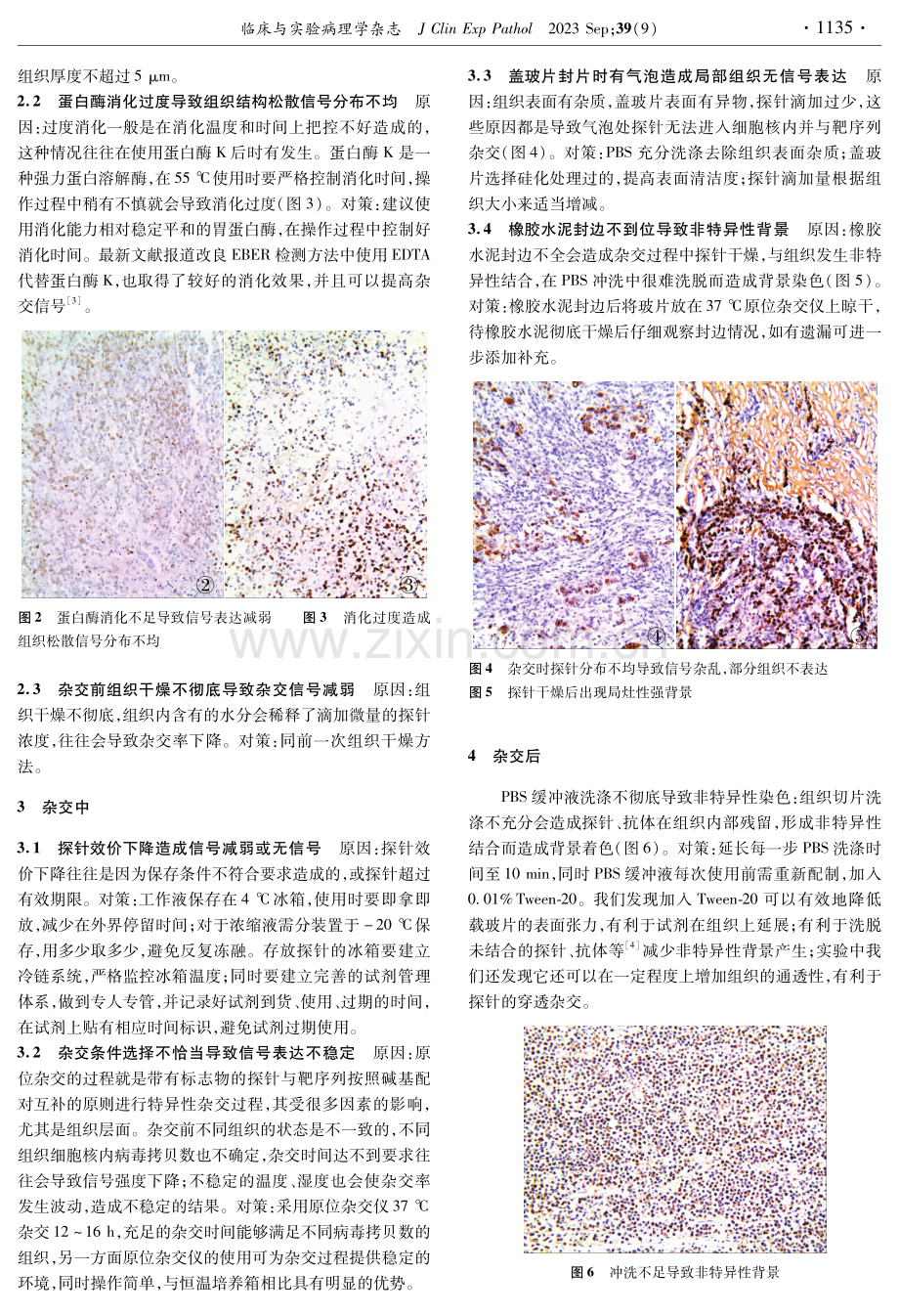 EBER原位杂交手工检测常见问题与对策.pdf_第2页