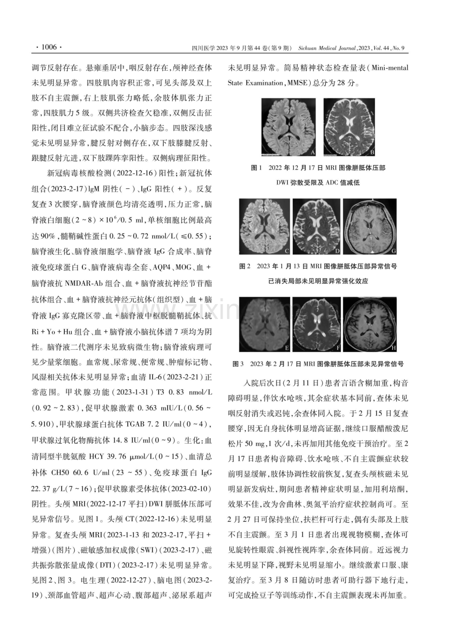 COVID-19相关性胼胝体压部细胞毒性水肿1例.pdf_第2页