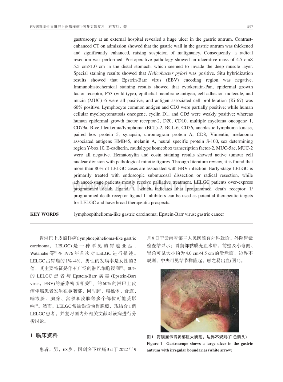 EB病毒阴性胃淋巴上皮瘤样癌1例并文献复习.pdf_第2页