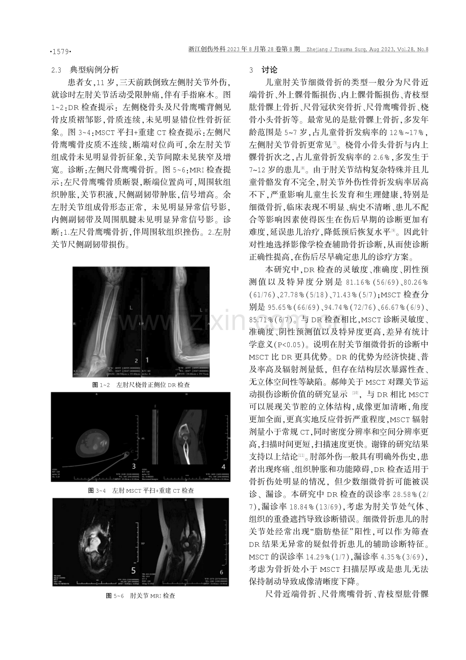 DR及MSCT在儿童肘关节不同类型细微骨折中的诊断价值研究.pdf_第3页