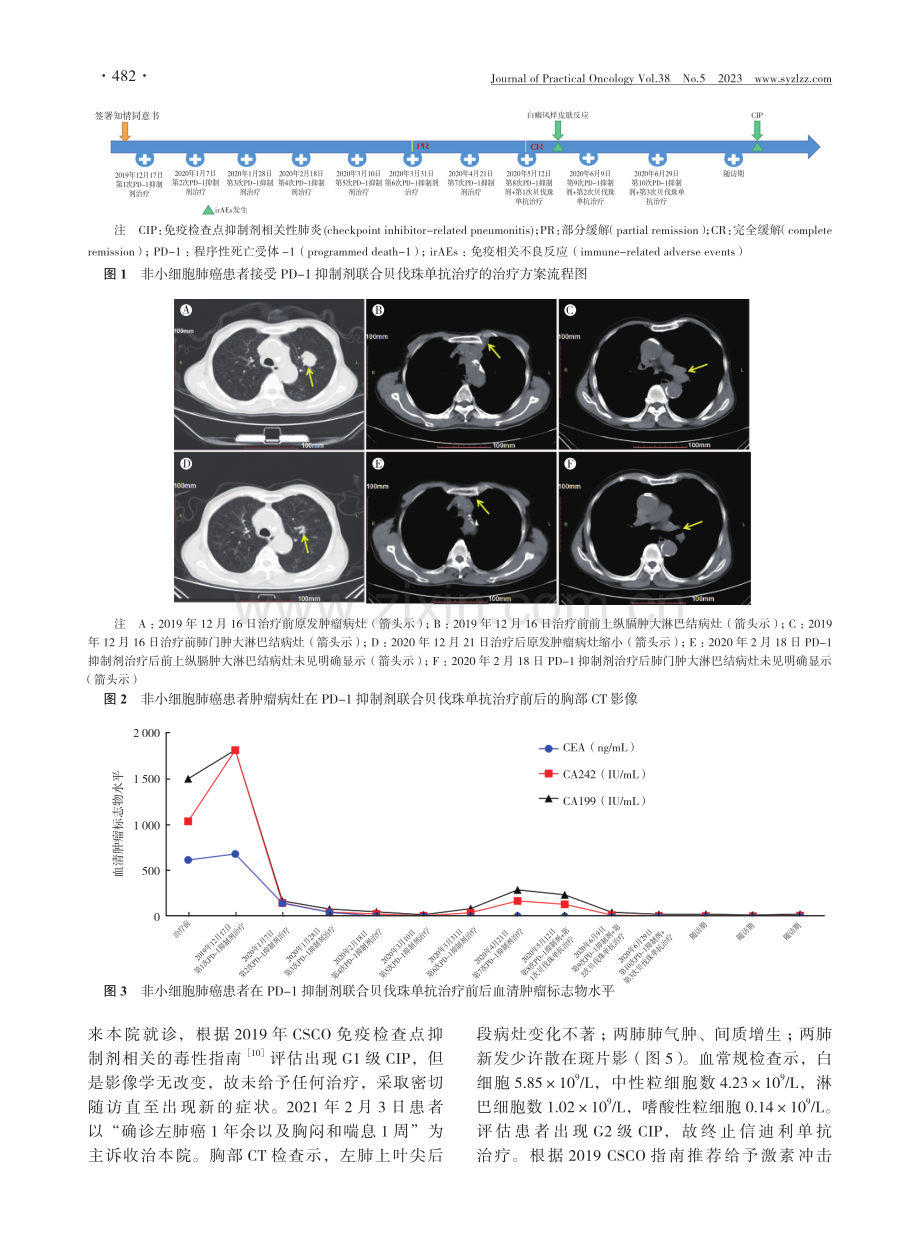 PD-1抗体治疗肺癌出现白癜风样皮肤反应和免疫检查点抑制剂相关性肺炎一例.pdf_第3页