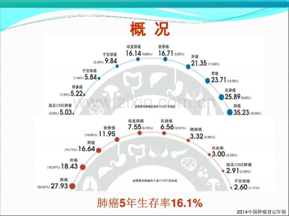 非小细胞肺癌NSCLC靶向治疗新进展.pptx_第2页