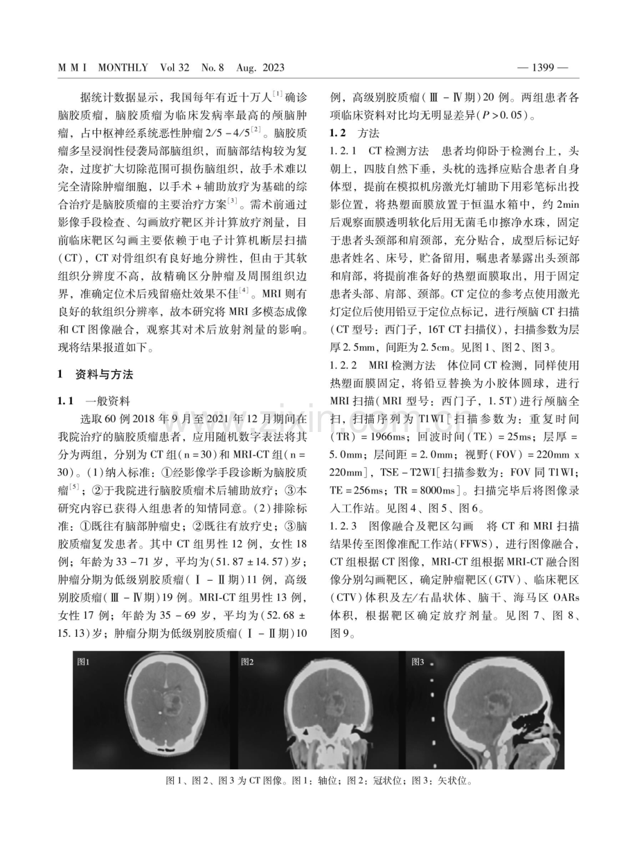 MRI多模态成像与CT图像融合技术对脑胶质瘤术后放疗患者放射剂量定制的影响.pdf_第2页