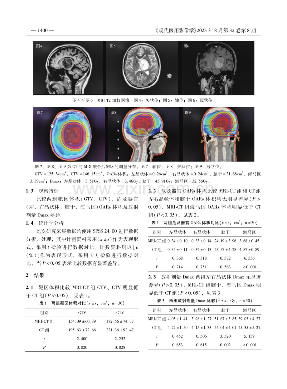 MRI多模态成像与CT图像融合技术对脑胶质瘤术后放疗患者放射剂量定制的影响.pdf_第3页