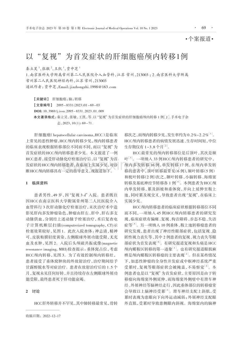 以“复视”为首发症状的肝细胞癌颅内转移1例.pdf_第1页