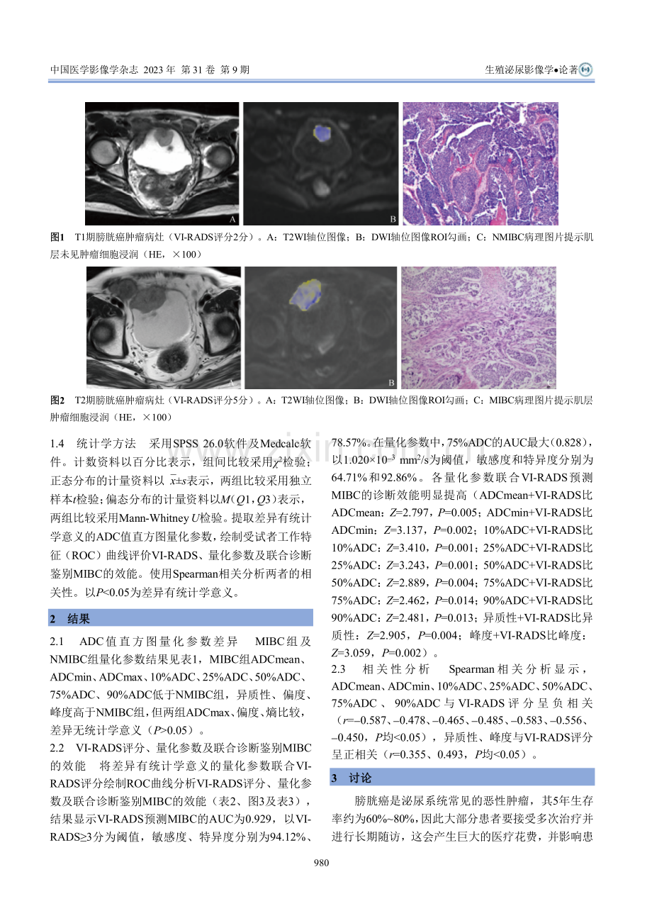 VI-RADS评分和ADC值直方图在膀胱癌肌层浸润中的诊断价值及其相关性.pdf_第3页