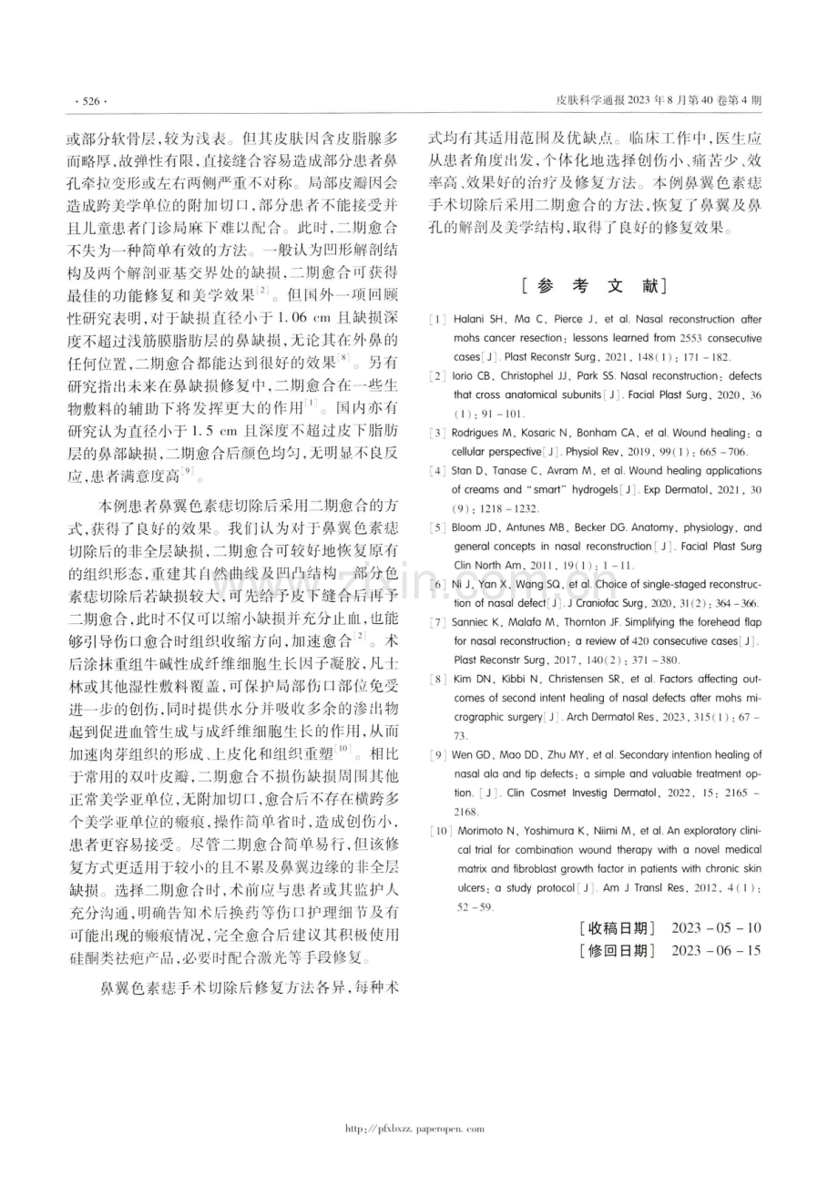 鼻翼色素痣切除后二期愈合1例.pdf_第3页