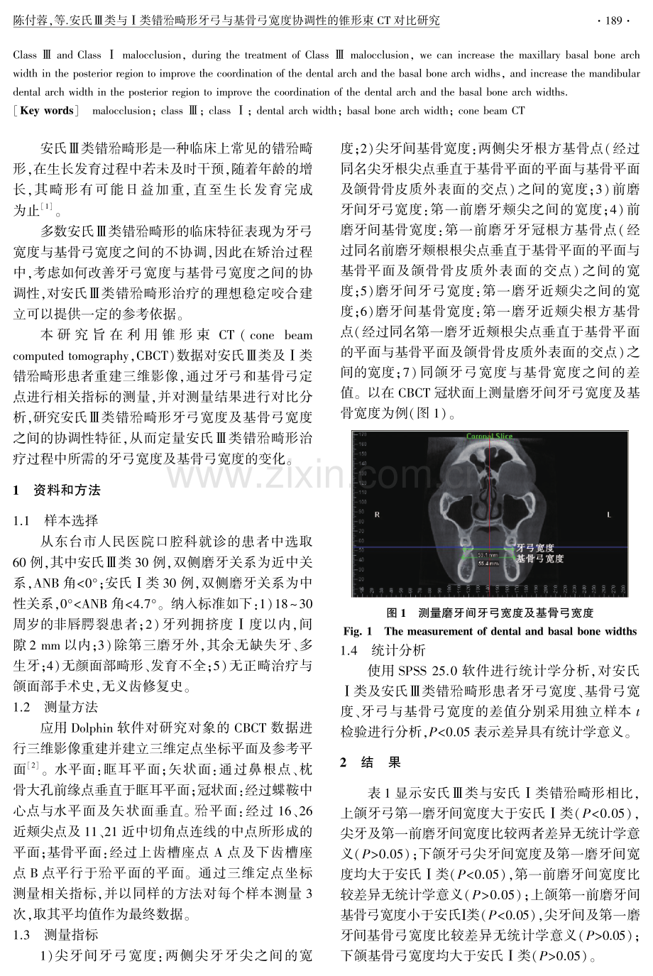 安氏Ⅲ类与Ⅰ类错牙合畸形牙弓与基骨弓宽度协调性的锥形束CT对比研究.pdf_第2页