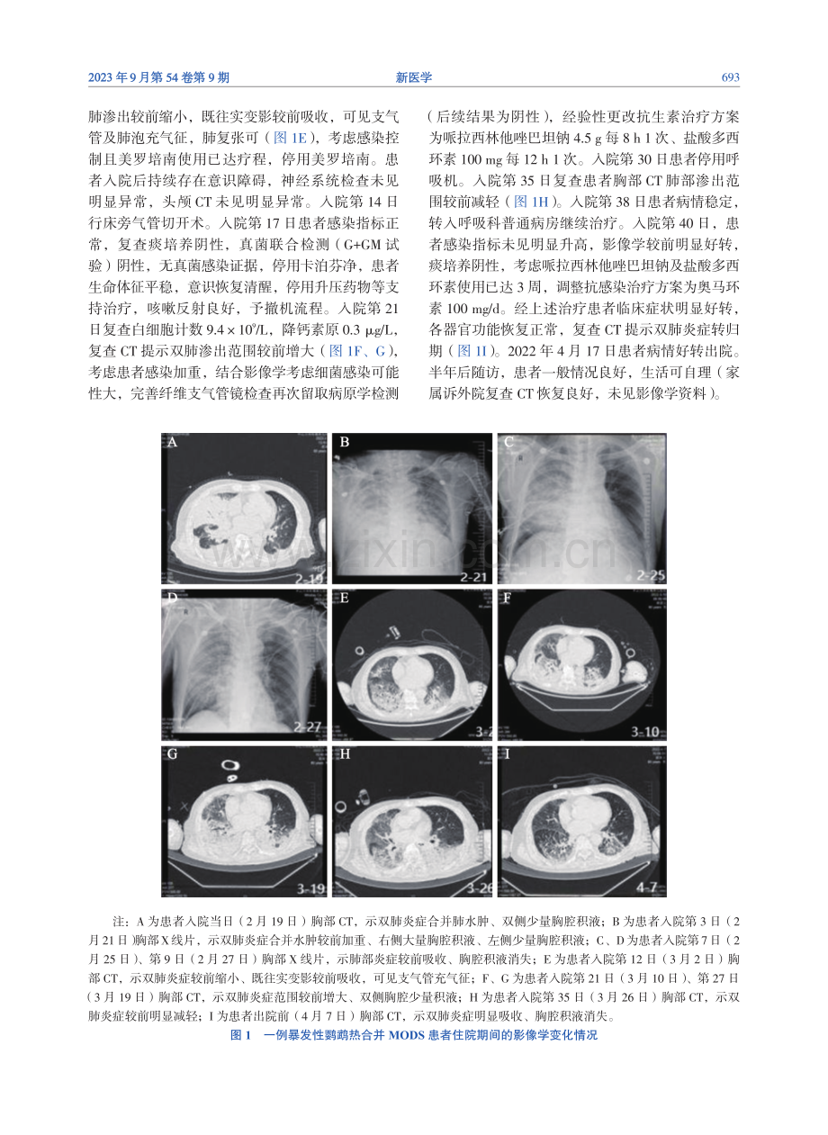 暴发性鹦鹉热合并多器官功能衰竭综合征一例报告.pdf_第3页