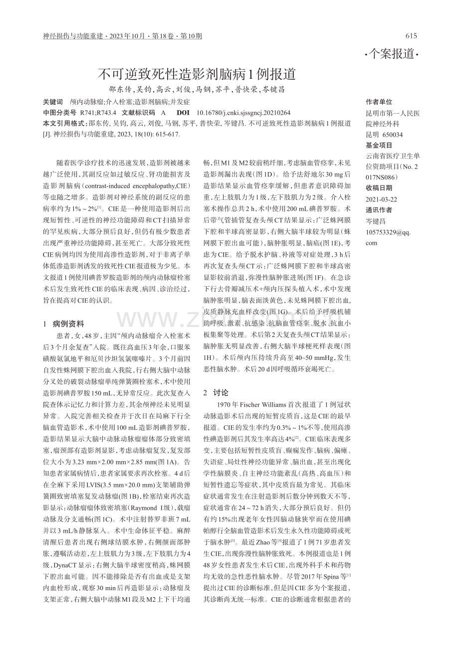 不可逆致死性造影剂脑病1例报道.pdf_第1页