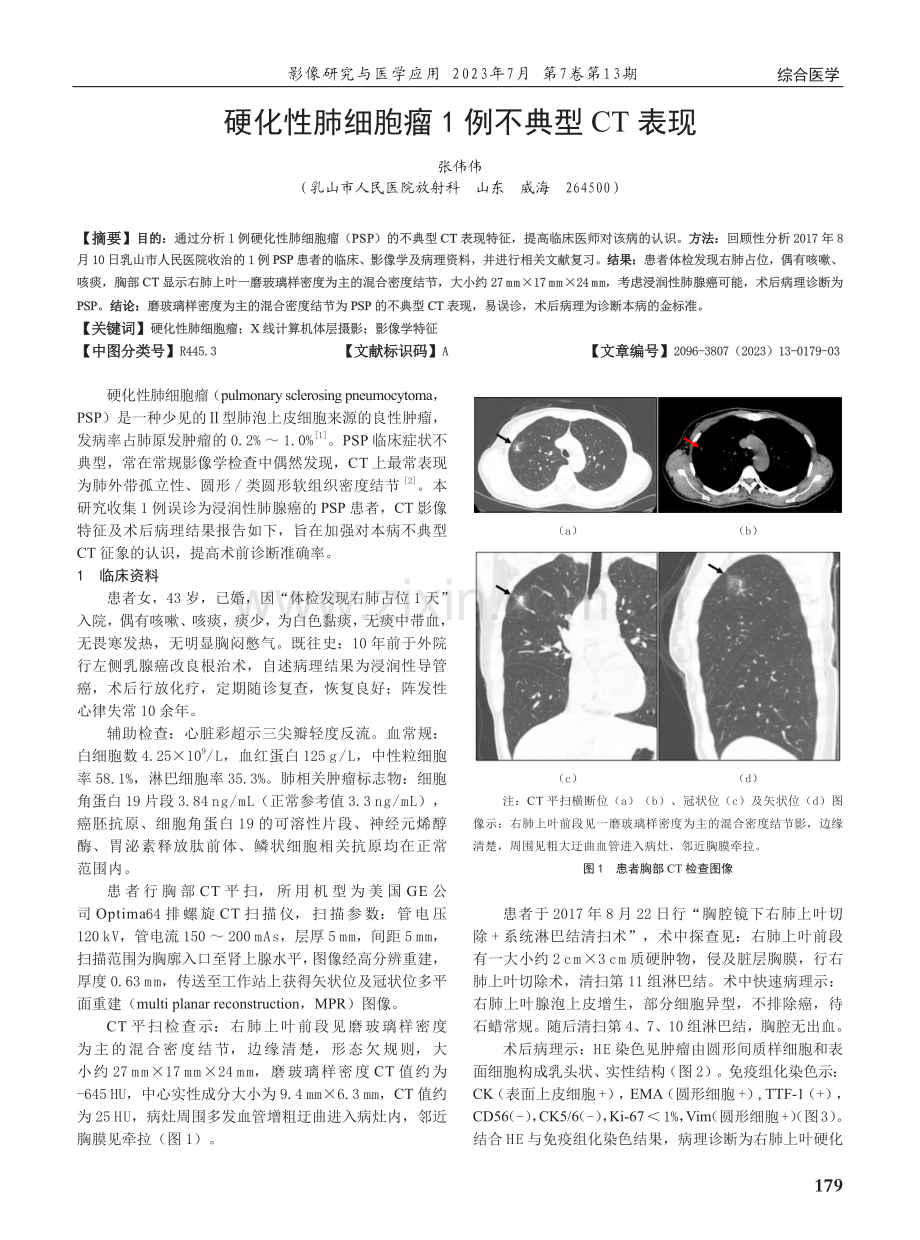 硬化性肺细胞瘤1例不典型CT表现.pdf_第1页